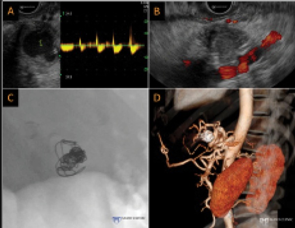 The Frontiers of Therapeutic Endoscopic Ultrasound